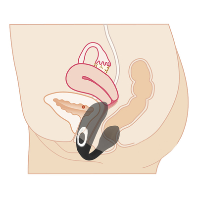 Wasserdichtes Wiederaufladbares G-Punkt-Vibrator Anal-Klitoris-Vibrator für Frauen FOB Referenzpreis:Erhalten Sie den neuesten Preis
