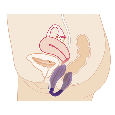 Wasserdichtes Wiederaufladbares G-Punkt-Vibrator Anal-Klitoris-Vibrator für Frauen FOB Referenzpreis:Erhalten Sie den neuesten Preis